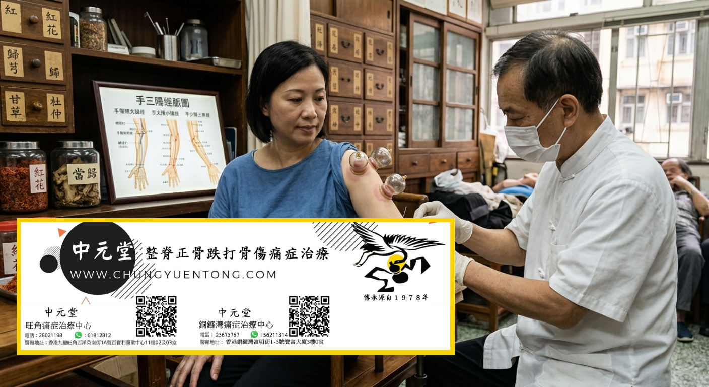 肌肉緊繃舒緩方法:全身僵硬酸痛怎麼辦 - 中元堂註冊中醫師親診 肌肉緊繃舒緩方法:全身僵硬酸痛怎麼辦 - 上臂拔罐配合針灸 - 中元堂註冊中醫師親診上肢痠痛網球肘 - 香港中醫拔罐針灸綜合調理